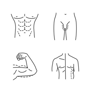 整形手术线性图标设置。 男性身体轮廓臂举手术男性冷却。 细线轮廓符号。 孤立矢量轮廓插图。 可编辑行程