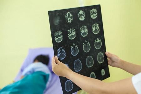 火锅店片头医生看脑x射线亚洲男孩在医院发生意外x射线片头疾病男孩由