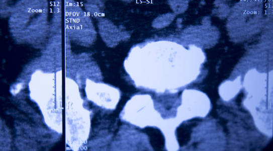 医疗医院x射线髋部脊柱骨盆MRI创伤扫描。
