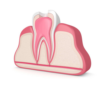 牙床根管治疗的三维渲染