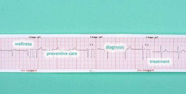 绿色背景下的心电图