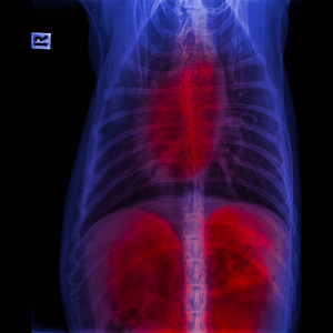 犬前视X线闭合于胸廓标准和胸部，胸部呼吸系统和肝痛区红色突出，兽医和兽医解剖概念