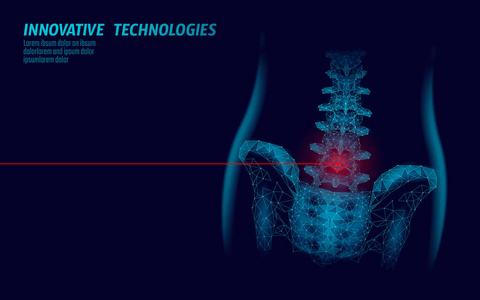 人脊柱髋关节性痛低聚。几何多边形粒子三角形点线未来医学技术蓝色红色痛苦区域向量图