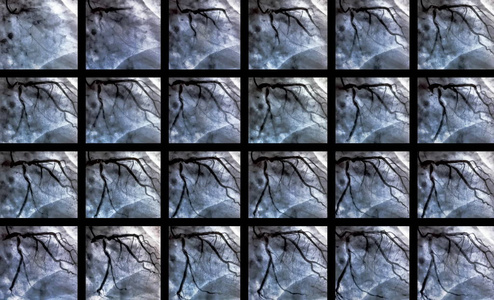 导尿。 心脏心室造影是一种医学影像学检查，用于确定患者右心室或左心室的心功能