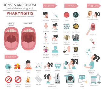 扁桃体和咽喉疾病。 咽炎症状治疗图标设置。 医学信息设计。 矢量插图