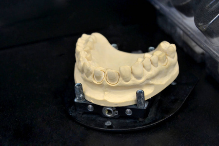 人颌骨人牙模型