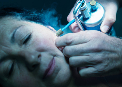 女性接受局部冷冻治疗.照片