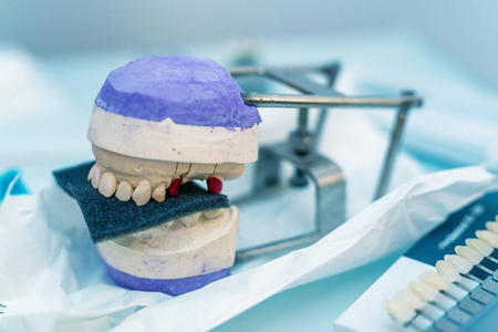 假牙组织在一个白色和紫色的支持，隔离在牙科室上。