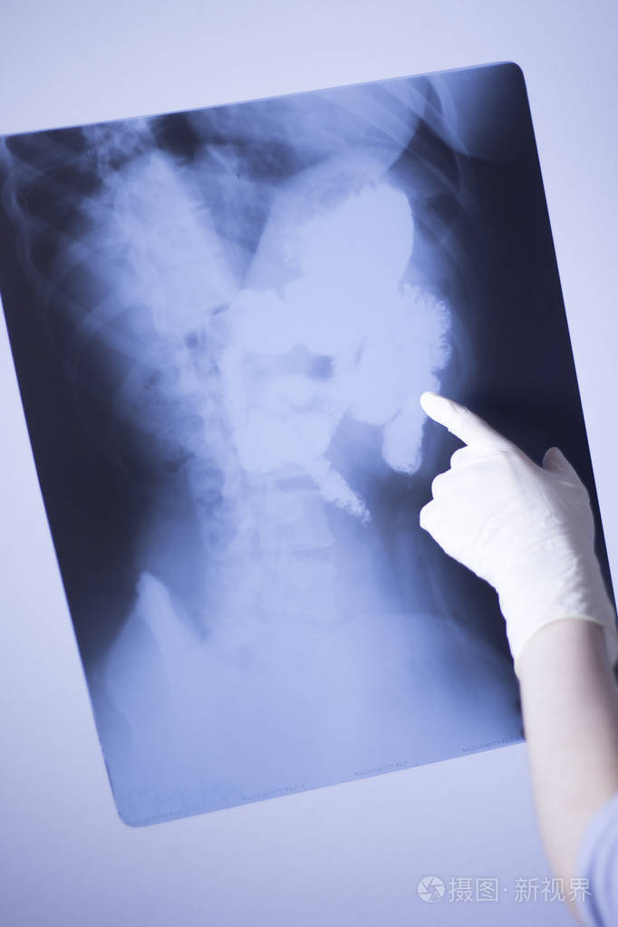 照片 医疗医院x射线腰痛脊柱和臀部创伤扫描也显示胃和器官.jpg