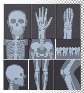 现实的 x 射线射击集合的向量例证。头部骨骼牙齿组身体部位的 x 线照片设置在透明背景上