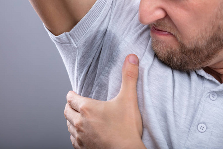 点豆腐男子多汗症在腋下汗出甚差照片