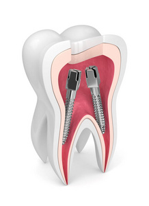 牙根牙柱在白色上的三维渲染