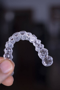 隐形牙对齐托槽，用于对每颗牙齿在美容牙科为病人。