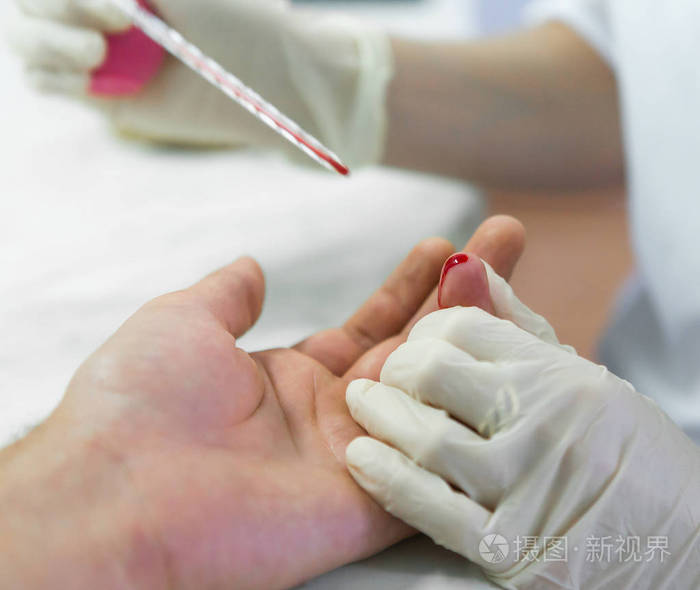 实验室的手指血液测试医生刺穿了一根手指快关门