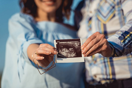 怀孕夫妇举行超声波扫描。怀孕保健概念