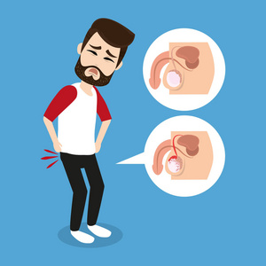 前列腺癌运动图片