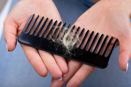 s Hand Holding Comb With Hair Loss