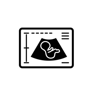 怀孕超声波黑色图标, 载体标志上孤立的背景.