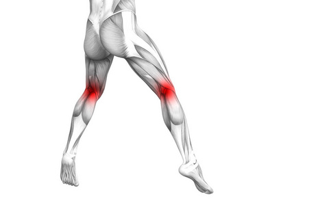 概念膝关节人体解剖与红色热点炎症或关节疼痛的腿部保健治疗或运动肌肉概念。 男子关节炎或骨质疏松症
