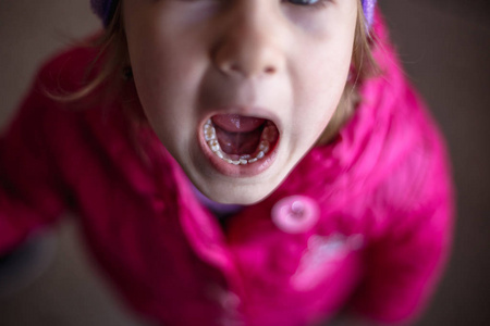 成人恒牙从婴儿牙齿后面进来:鲨鱼牙齿. 张开小女孩的嘴.照片