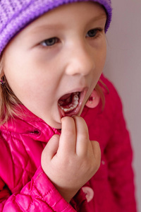 成人恒牙从婴儿牙齿后面进来鲨鱼牙齿。 张开小女孩的嘴。