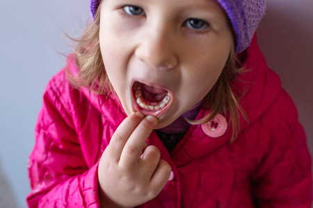 成人恒牙从婴儿牙齿后面进来:鲨鱼牙齿. 张开小女孩的嘴.照片