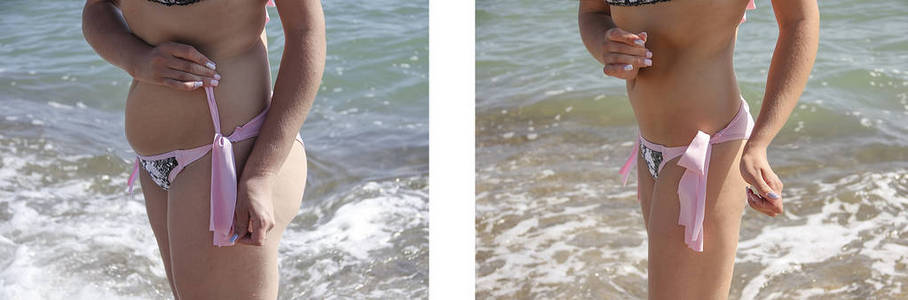 穿泳装的女孩减肥前后图片