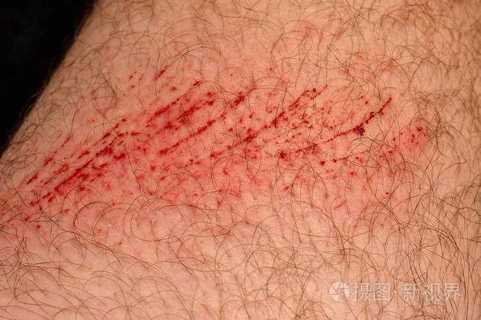 多毛的人体特写部分.