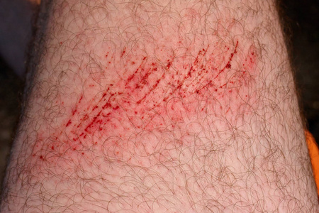 多毛图片-多毛素材-多毛插画-摄图新视界