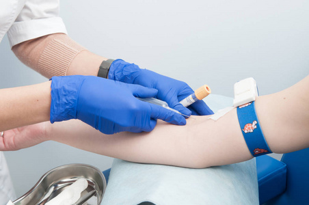 女性抽血护士从静脉抽血照片