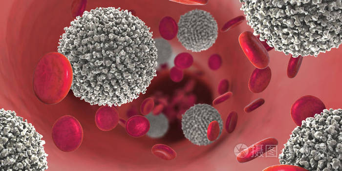 非功能性白细胞称为白血病细胞强烈增加导致血癌的三维图