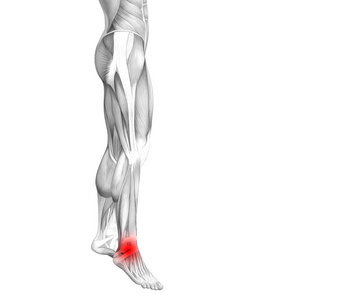 概念踝关节人体解剖与红色热点炎症或关节疼痛的腿部保健治疗或运动肌肉概念。 男子关节炎或骨质疏松症