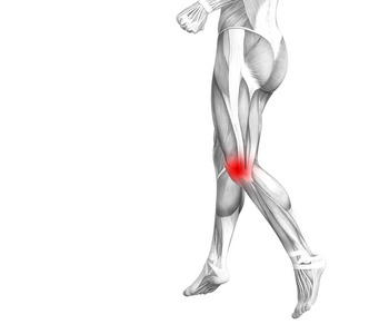概念膝关节人体解剖与红色热点炎症或关节疼痛的腿部保健治疗或运动肌肉概念。 男子关节炎或骨质疏松症