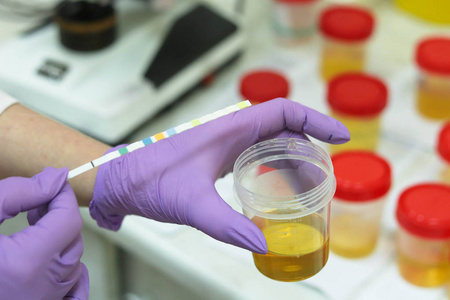 黄色液体试验临床医学实验室尿液检查.照片