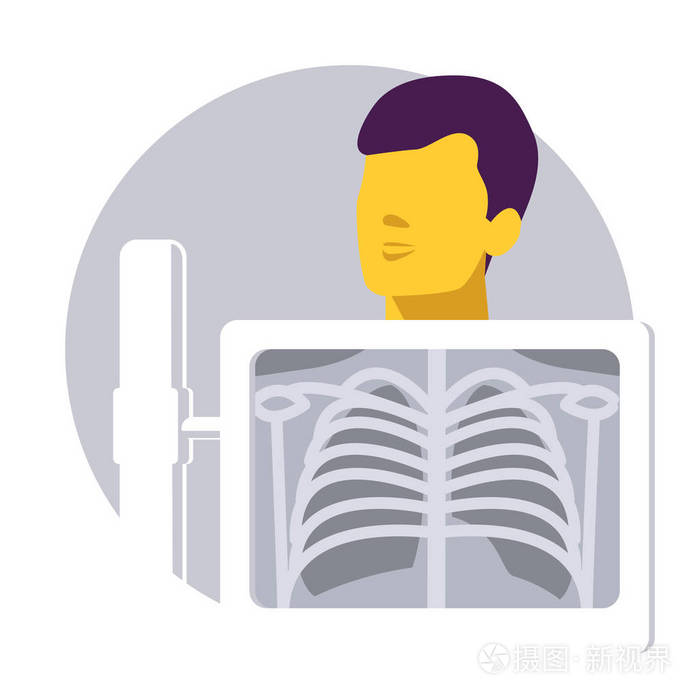 胸部x光. 检查肺癌,肺炎,结核病. 肺癌意识. 矢量图.