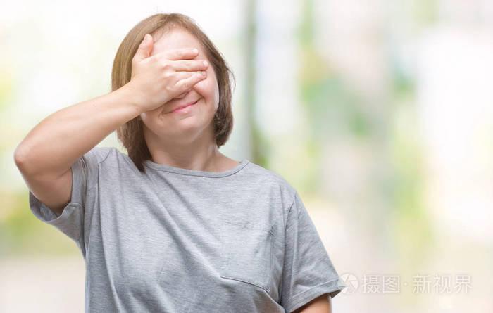 患有唐氏综合症的年轻成年妇女用手捂着眼睛微笑