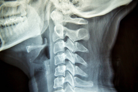 办公室人颈椎痛图片