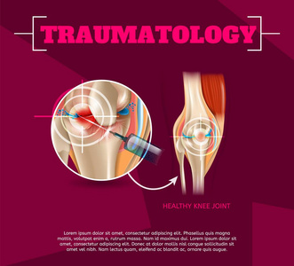 现实的说明创伤医学在3d