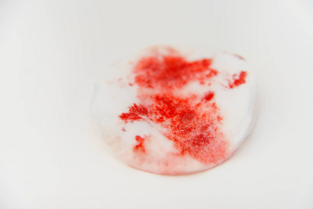 带血的棉花盘。 带有红色血液痕迹的棉花盘。 棉花海绵上的旧干血。 伤口后的血迹。 白色背景上的棉签。