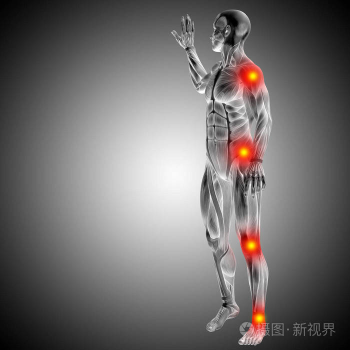 人体解剖结构疼痛和炎症的概念三维图示,灰色梯度背景