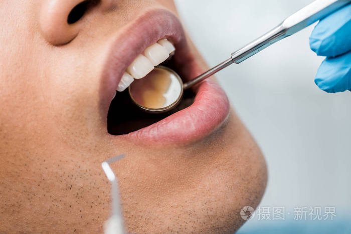 美国黑人男子张开嘴看医疗器械