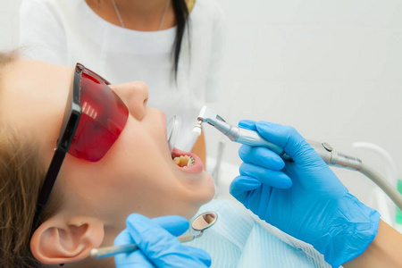 特写医疗牙医程序的牙齿抛光清洗从牙科存款和 odontolith