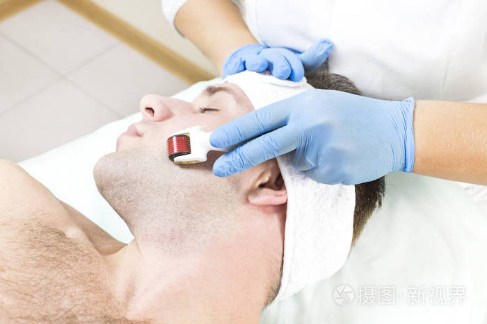 这个人用现代医疗器械真皮滚筒进行医用微针治疗