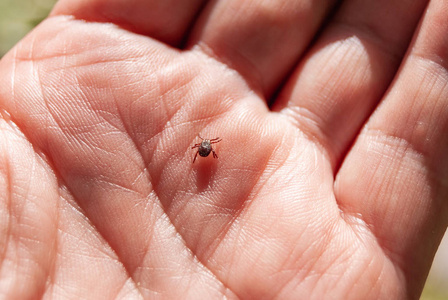 蜱虫在人的手掌上. 蜱绕着人的手臂四处游荡,传播蜱传播脑炎照片