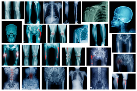 高质量的X射线图像显示人体的许多身体部位
