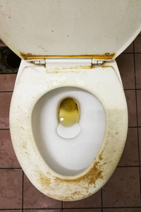 脏厕所脏的臭的带有污渍的公共厕所碗照片