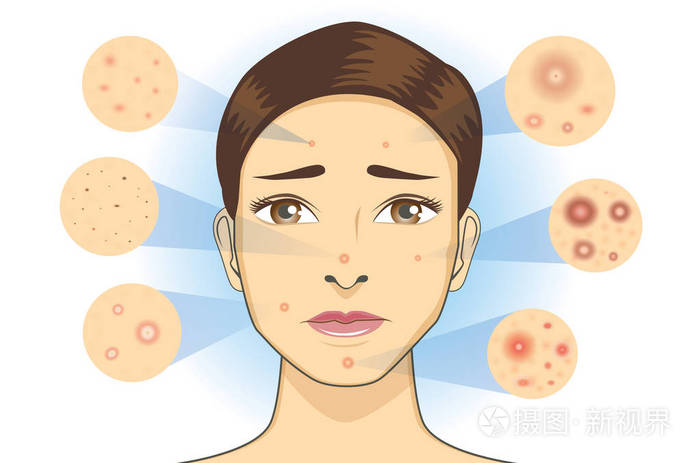 关于皮肤科图的插图.