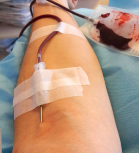 在医院献血时拿着针的男孩照片