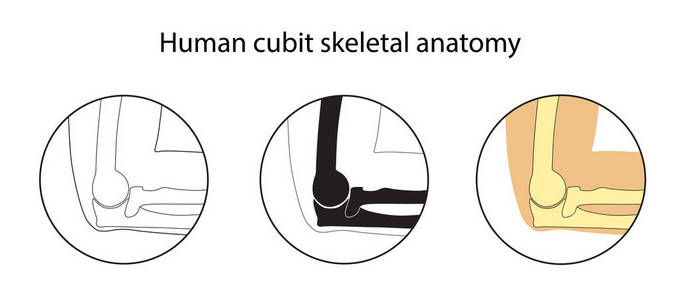 人体肘骨骼解剖学的向量例证集合