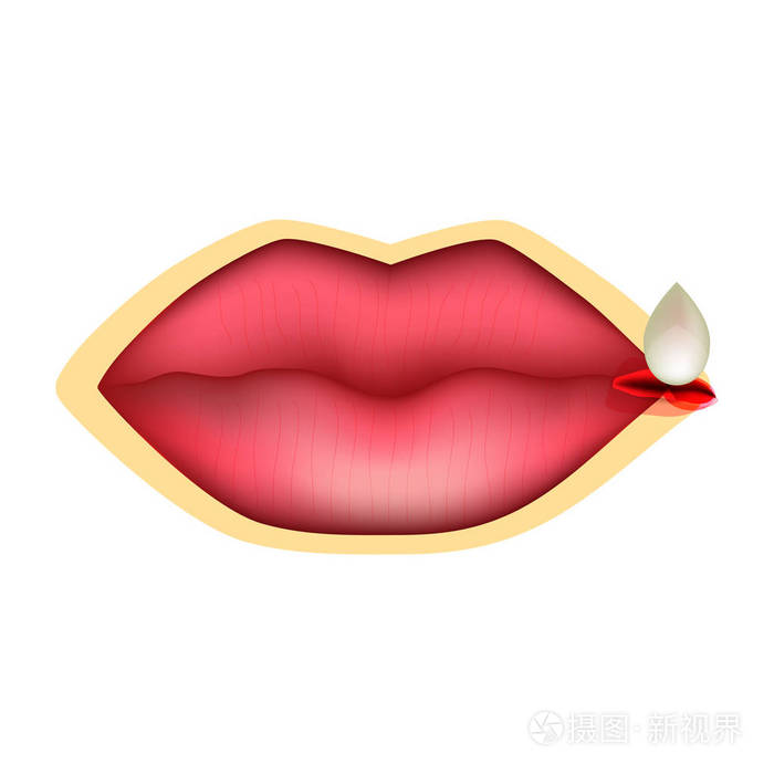 治疗嘴唇裂开 一滴药 信息图表 孤立背景矢量图插画 正版商用图片16f1j3 摄图新视界